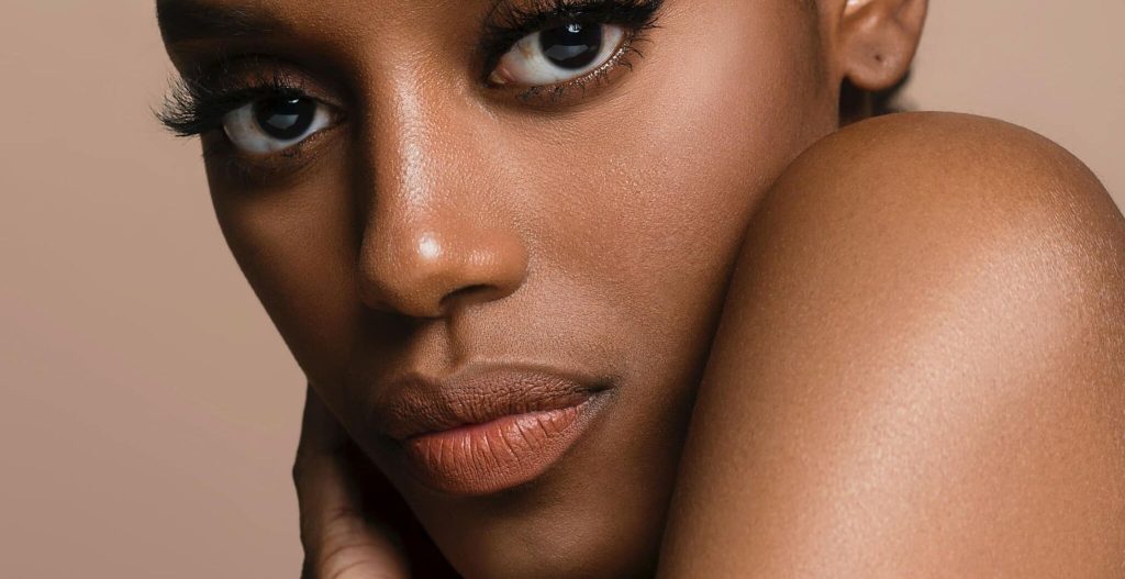 Read more about the article Pigmentation Concerns Melasma