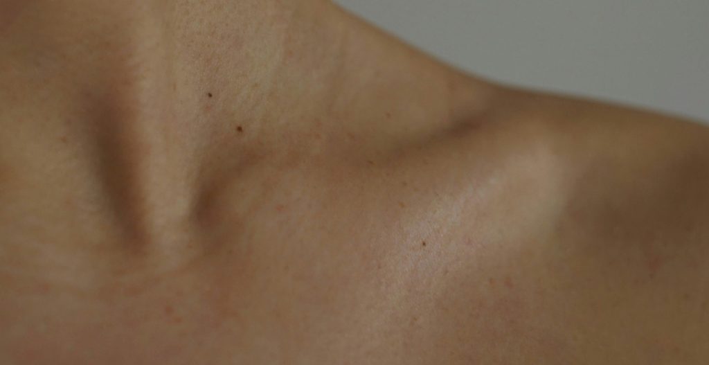 Read more about the article Dark Spots Explained: A Smarter Way to Manage Pigmentation
