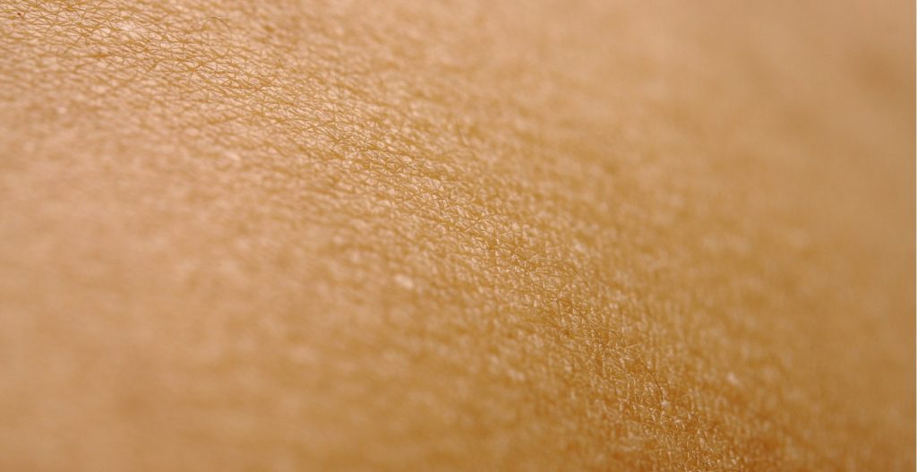 Read more about the article Dry Skin Hyperpigmentation: Why Barrier-First Brightening Matters in Winter